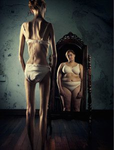 eating disorder, anorexia, bulimia, over eating, binge eating, food, disorder, solution, mynd.works